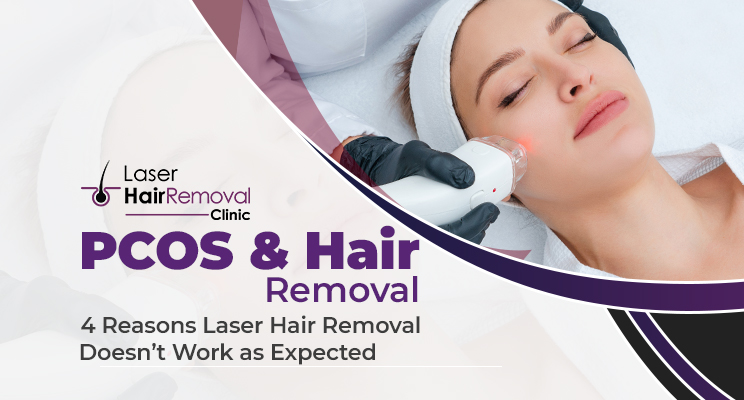 Pcos And Hair Removal The Laser Hair Removal