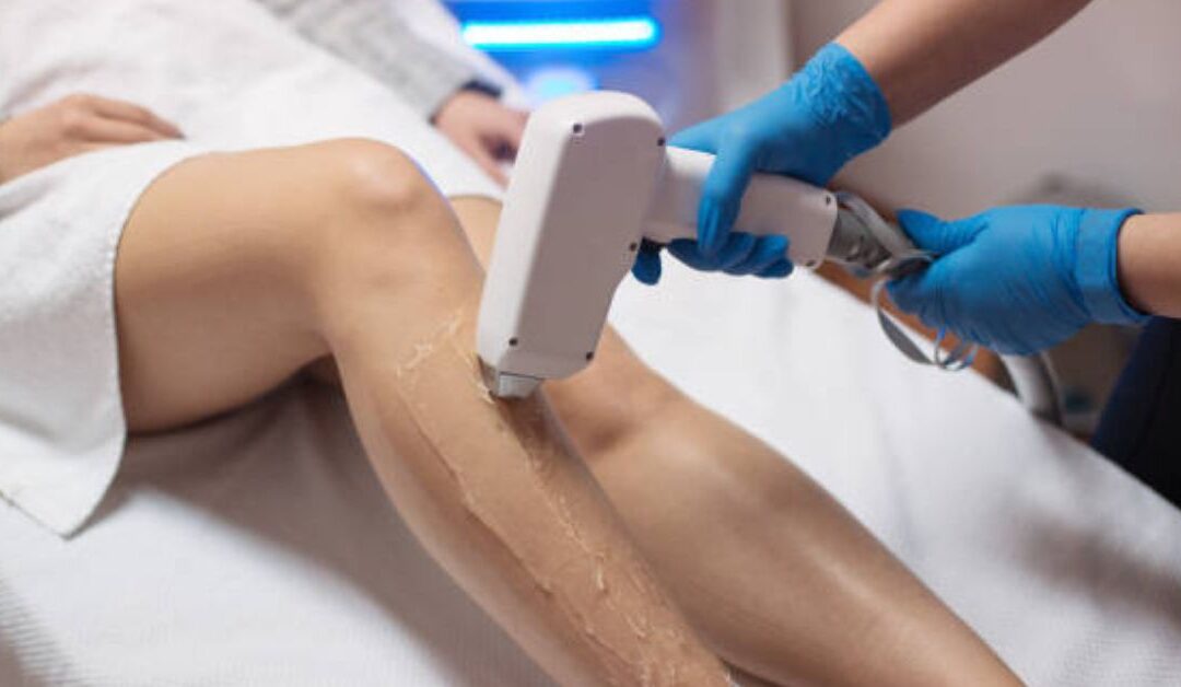 All You Need to Know About Laser Hair Removal